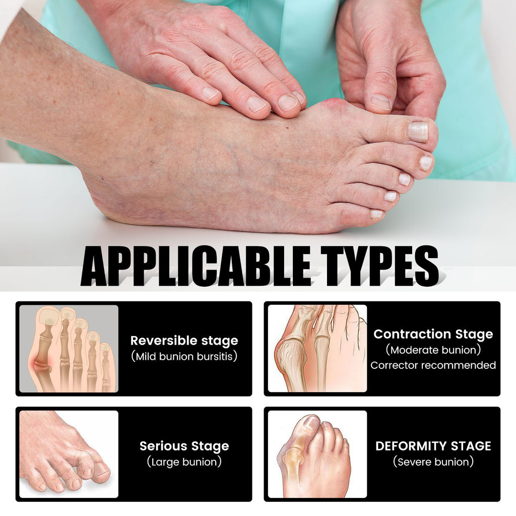 Toe Alignment Socks, Cotton & Nylon
