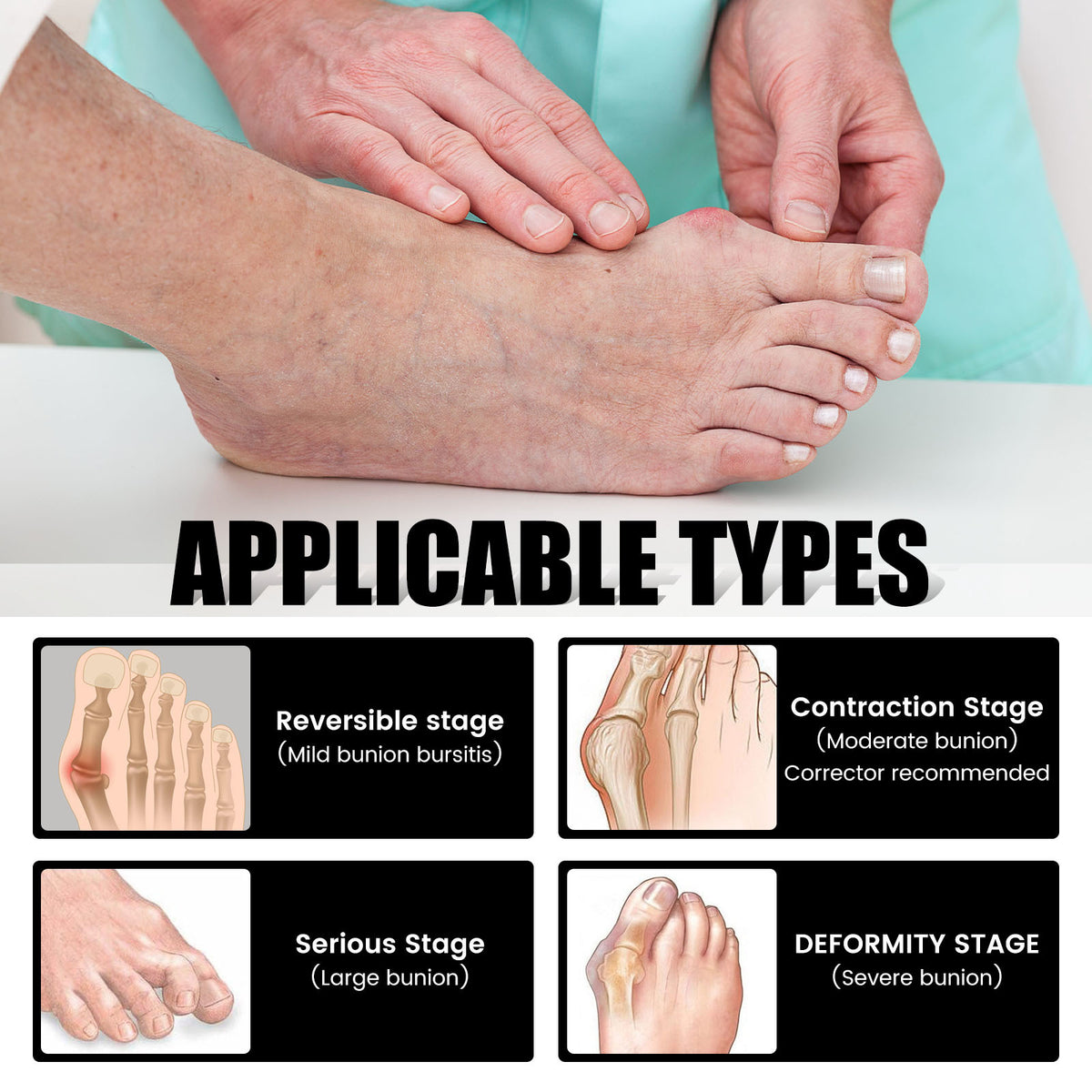 Toe Alignment Socks, Cotton & Nylon