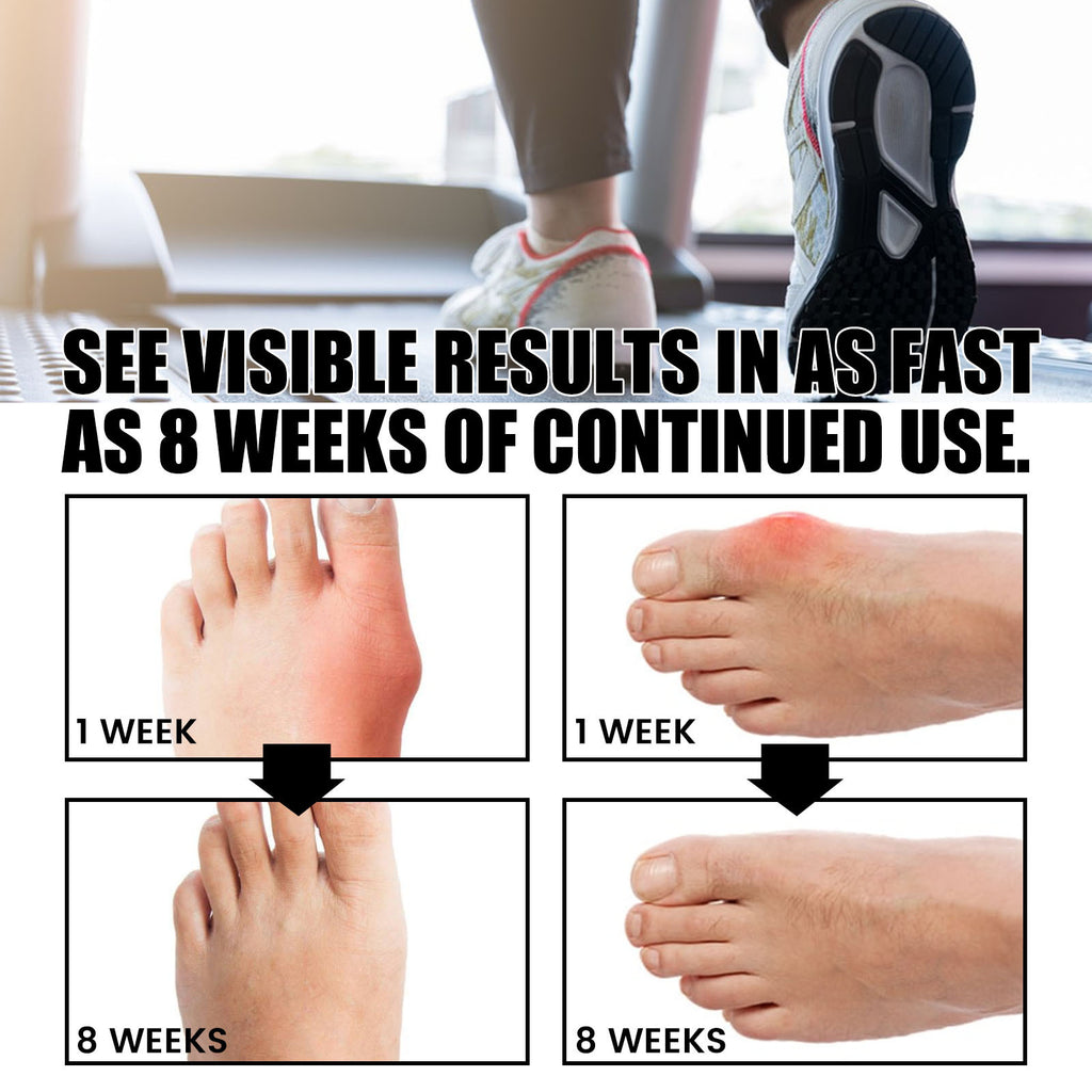 Toe Alignment Socks, Cotton & Nylon